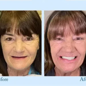 ๐๐ข๐๐จ๐ง๐ยฎ ๐๐ซ๐๐ฆ๐ข๐ฎ๐ฆ ๐๐๐ง๐ญ๐ฎ๐ซ๐