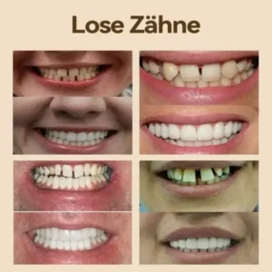 𝐇𝐢𝐝𝐨𝐧𝐞®🚀 – 🦷𝐏𝐫𝐞𝐦𝐢𝐮𝐦 𝐆𝐞𝐛𝐢𝐬𝐬🦷(✨Geeignet für alle Mundformen, speziell angefertigte Zahnersätze für die perfekte Passform✨)