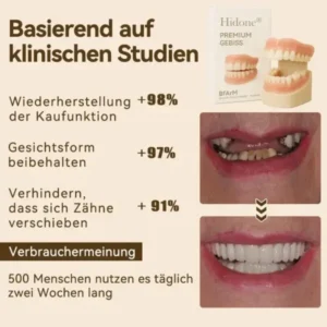 𝐇𝐢𝐝𝐨𝐧𝐞®🚀 – 🦷𝐏𝐫𝐞𝐦𝐢𝐮𝐦 𝐆𝐞𝐛𝐢𝐬𝐬🦷(✨Geeignet für alle Mundformen, speziell angefertigte Zahnersätze für die perfekte Passform✨)