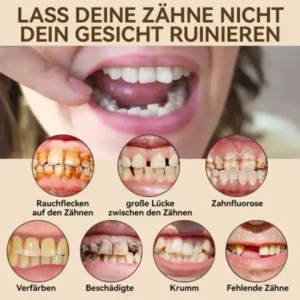 𝐇𝐢𝐝𝐨𝐧𝐞®🚀 – 🦷𝐏𝐫𝐞𝐦𝐢𝐮𝐦 𝐆𝐞𝐛𝐢𝐬𝐬🦷(✨Geeignet für alle Mundformen, speziell angefertigte Zahnersätze für die perfekte Passform✨)