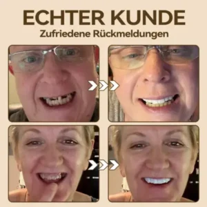 𝐇𝐢𝐝𝐨𝐧𝐞®🚀 – 🦷𝐏𝐫𝐞𝐦𝐢𝐮𝐦 𝐆𝐞𝐛𝐢𝐬𝐬🦷(✨Geeignet für alle Mundformen, speziell angefertigte Zahnersätze für die perfekte Passform✨)