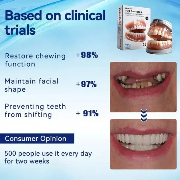 Hidone® Full Denture Set🦷🦷💃Advanced Self-Adjusting Dental Materials (⏰Limited time discount last 30 minutes⏰)
