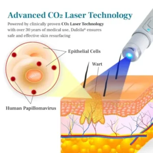 Slimoly™ LumeSkin Mole and Wart Removal Laser Pen