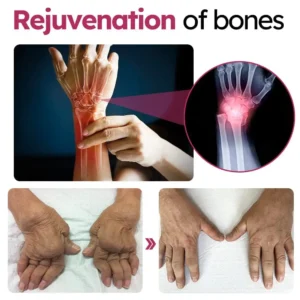 Slimoly™ Advanced Joint & Bone Renewal Cream