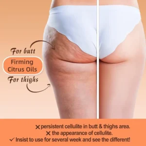 Slimoly Anti Cellulite Massage Oil - Skin Tightening, Moisturizing