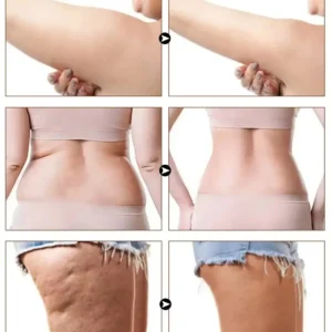 Slimoly Anti Cellulite Massage Oil - Skin Tightening, Moisturizing