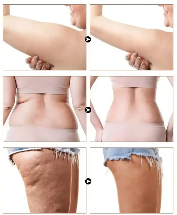 Slimoly Anti Cellulite Massage Oil - Skin Tightening, Moisturizing