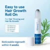 Slimoly™ Anti-Hair Loss Roll-On – Stop Shedding & Boost Growth