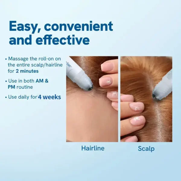 Slimoly™ Anti-Hair Loss Roll-On – Stop Shedding & Boost Growth