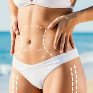 Slimoly® Japanese Slim Patch – Gentle, Smart Fat Burn