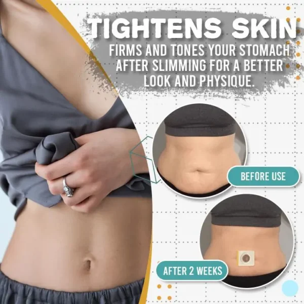 Slimoly® Japanese Slim Patch – Gentle, Smart Fat Burn