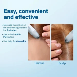 Slimoly™ Professional Anti-Hair Loss Roll-On – Stimulates Hair Growth in 1–2 Weeks