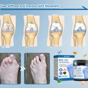 Slimoly® 𝑩𝗣𝗖-𝟭𝟓𝟳 𝗝𝗼𝗶𝗻𝘁 𝗛𝗲𝗮𝗹𝗶𝗻𝗴 𝗖𝗿𝗲𝗮𝗺🦴Treats Arthritis, Neuropathy, Rheumatism, Sports Injuries & More💪