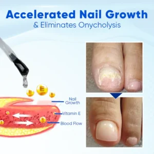 Slimoly™ Nail Growth and Repair Serum