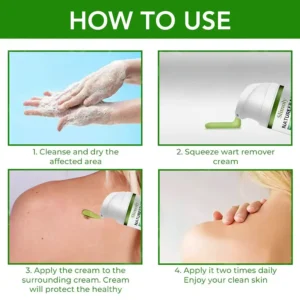 Slimoly™ NatureErase Instant Mole & Spot Cream