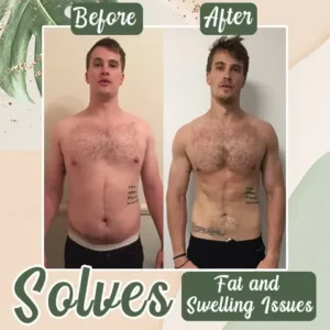 Slimoly™ Perfect Detox Slimming Patch