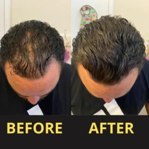 Slimoly™ Hair & Scalp Concealer 50ML - Waterproof 3–7 days.