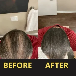 Slimoly™ Hair & Scalp Concealer 50ML - Waterproof 3–7 days.