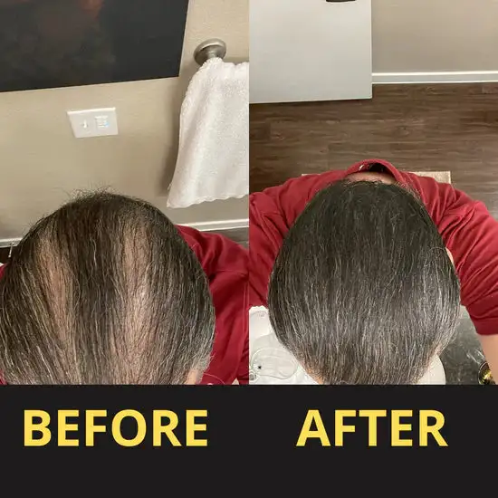 Slimoly™ Hair & Scalp Concealer 50ML - Waterproof 3–7 days.