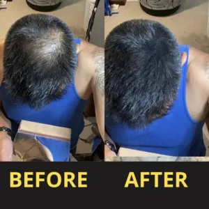 Slimoly™ Hair & Scalp Concealer 50ML - Waterproof 3–7 days.