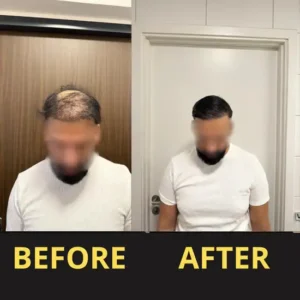 Slimoly™ Hair & Scalp Concealer 50ML - Waterproof 3–7 days.