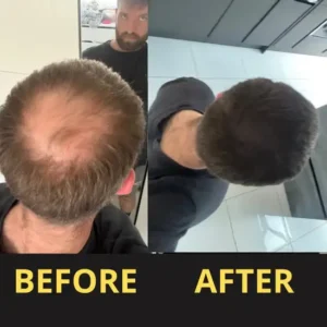 Slimoly™ Hair & Scalp Concealer 50ML - Waterproof 3–7 days.