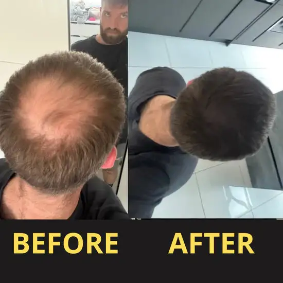 Slimoly™ Hair & Scalp Concealer 50ML - Waterproof 3–7 days.