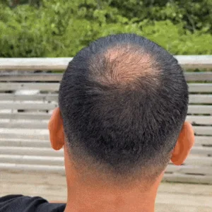 Slimoly™ Hair & Scalp Concealer 50ML - Waterproof 3–7 days.