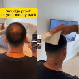 Slimoly™ Hair & Scalp Concealer 50ML - Waterproof 3–7 days.