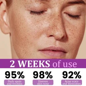 Slimoly™ MelantraX Advanced Anti-Hyperpigmentation Essence