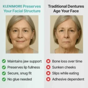 KLENIMORE™ Custom-Fit Fully Functional Dentures for a More Confident Smile!