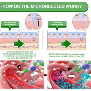 𝑴𝑼𝑹𝑾𝑶𝑵® 𝗕𝗲𝗿𝗯𝗲𝗿𝗶𝗻𝗲 𝟏𝟎-𝐢𝐧-𝟏 𝗡𝗮𝗻𝗼 𝗠𝗶𝗰𝗿𝗼𝗻𝗲𝗲𝗱𝗹𝗲 𝗣𝗮𝘁𝗰𝗵