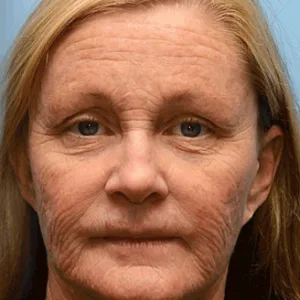 Rolimey® Botox & Vita-A Retinol Shot Tightening and Wrinkle-Reducing Cream