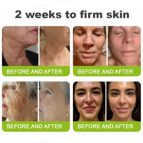 Rolimey® Botox & Vita-A Retinol Shot Tightening and Wrinkle-Reducing Cream