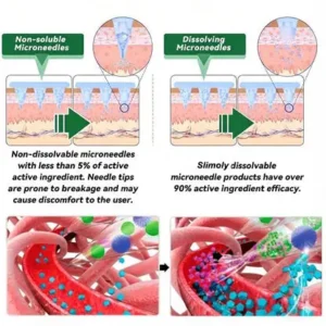 🔥 New Release | Slimoly® 20-IN-1 Advanced Nano Microneedle Patch  Moringa × Berberine × NMN/NAD+ Multi-Action Formula