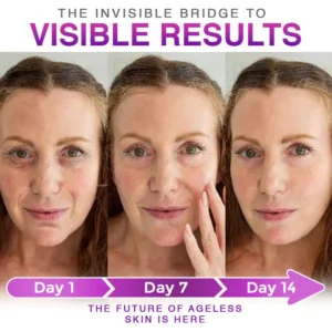 Slimoly™ 3-in-1 Microneedle Anti-Aging Patch