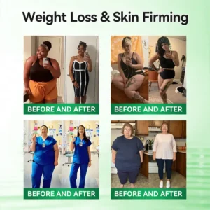 Official Store | 🍇 𝐒𝐥𝐢𝐦𝐨𝐥𝐲™ 12-IN-1 Moringa * Berberine * NAD+ Advanced Nano Microneedle Patch (Once Daily, visible changes in 7 days) For Obesity, Loose Skin, Diabetes, Sleep Apnea, And Joint Issues 🎀