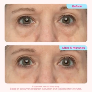 👀 Slimoly® Instant Eye Tightening Gel