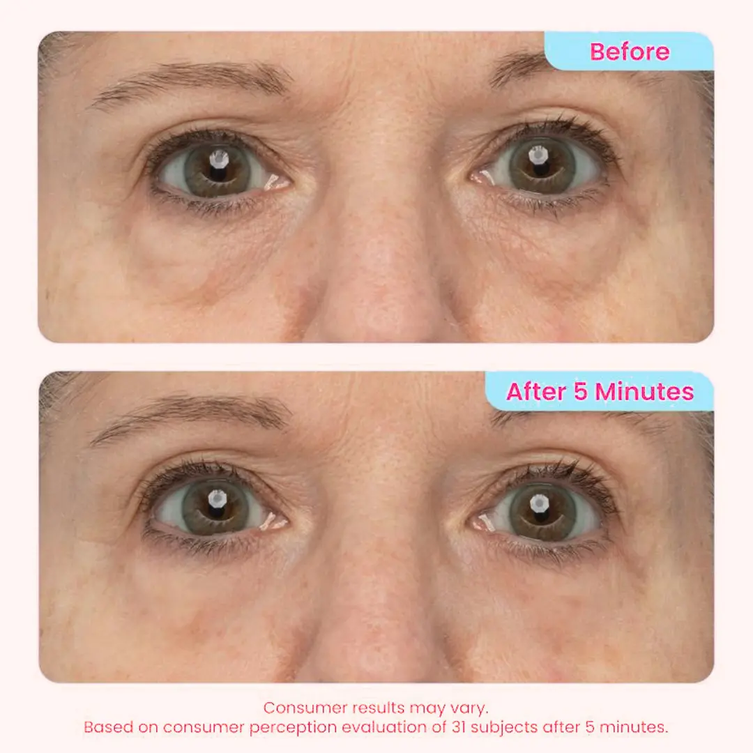 👀 Slimoly® Instant Eye Tightening Gel