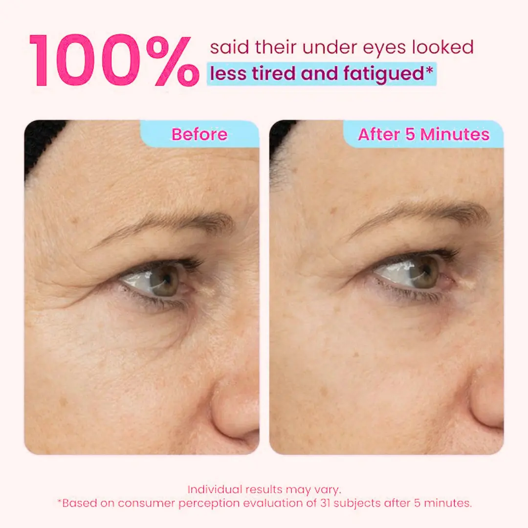 👀 Slimoly® Instant Eye Tightening Gel