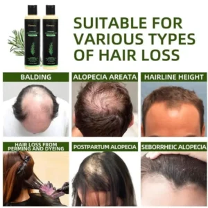 🔥LAST DAY 50% OFF - Slimoly® Organic Rosemary Hair Growth Shampoo